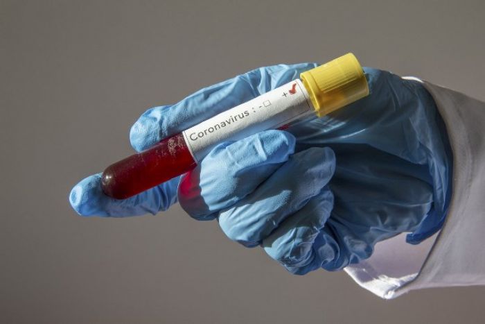 11 случаев заражения коронавирусом: 9 зарегистрировано в Жылыойском районе 