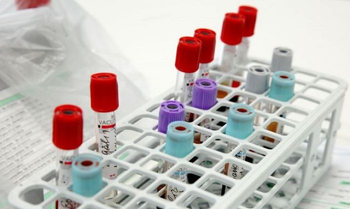 Еще 24 случая заражения коронавирусом в Казахстане 