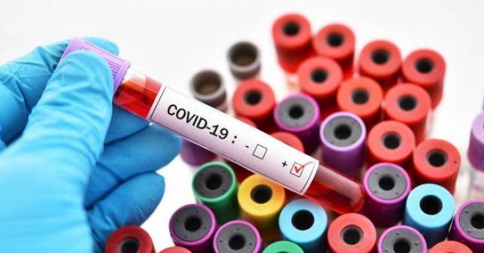 Четверо рабочих на Тенгизе заразились коронавирусом 