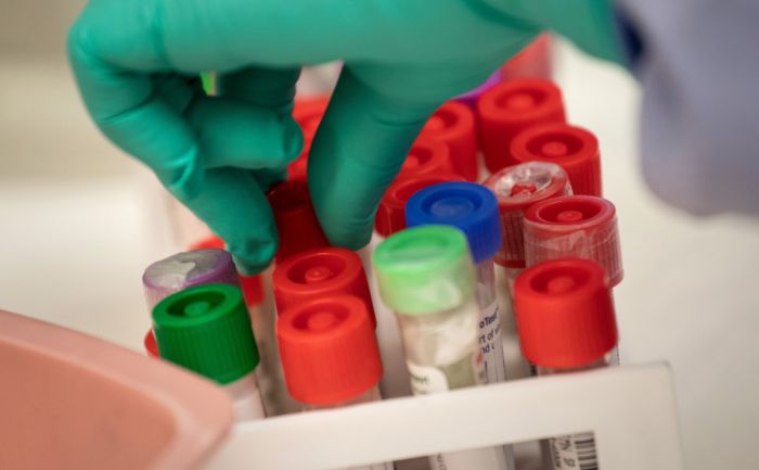 7 новых случаев коронавируса, 4 из них – в Атырау 