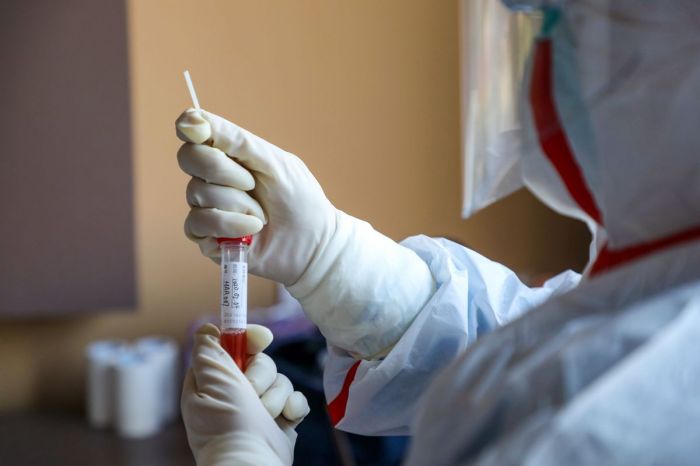 72 новых случая коронавируса в стране,  14 - в Атырау 