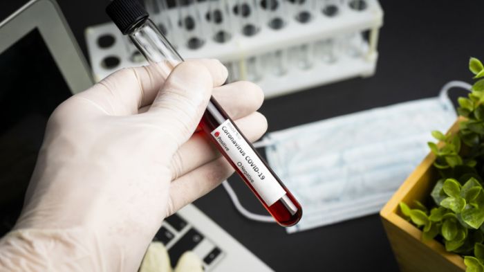 Восемь онкобольных казахстанцев заразились коронавирусом 