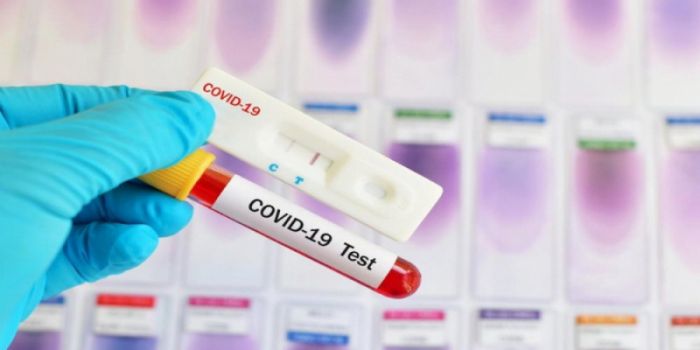 За минувшие сутки в стране выявлено 230 случаев заболевания коронавирусом 