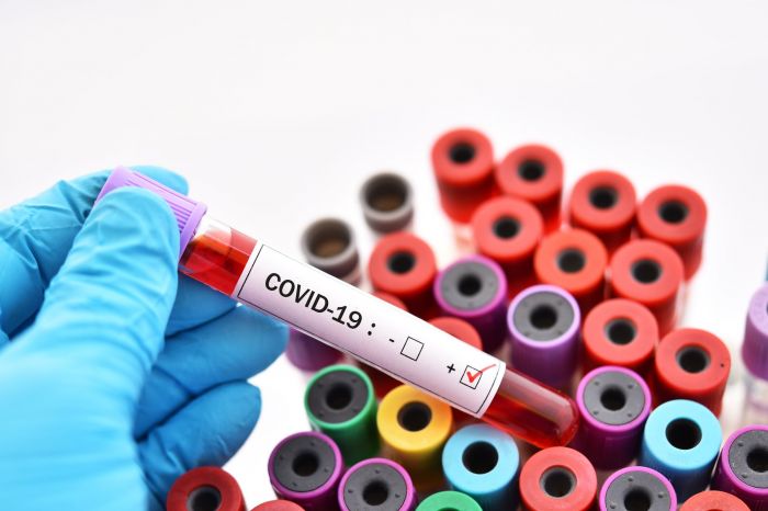 65 человек заразились коронавирусом за сутки, из них 9 - в Атырау 