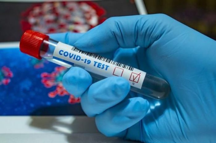 В Атырау 6 человек заразились коронавирусом за сутки 