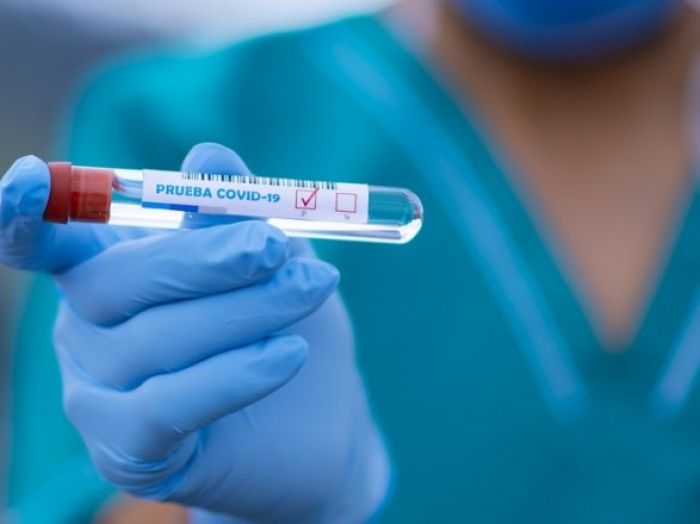 ​В Атырауской области за сутки выявлены 45 человек, заболевших коронавирусом