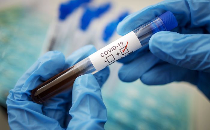 За сутки в стране выявлен 571 заболевший коронавирусом
