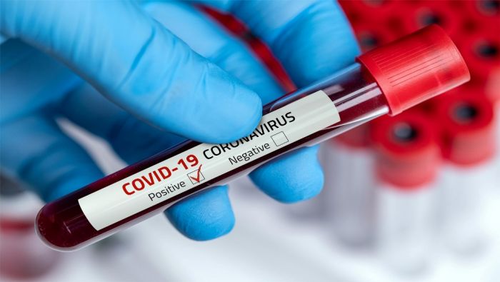 Более тысячи случаев коронавируса выявлено в Казахстане за сутки 