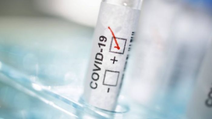 Больше тысячи новых заражённых коронавирусом выявили за сутки в стране
