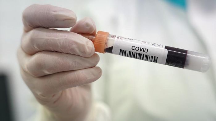 2877 заболевших коронавирусом выявили за сутки в стране