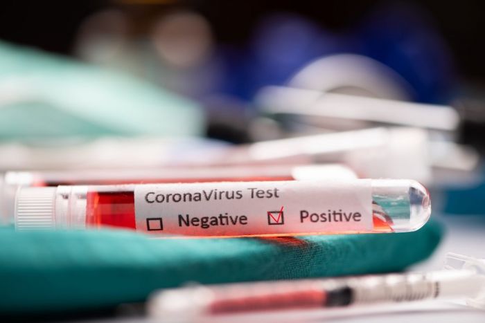 2350 случаев коронавируса выявили за сутки в Казахстане 