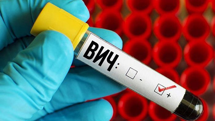 ВИЧ тоже не спит