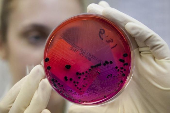 Сибирской язвой заразился житель Северо-Казахстанской области