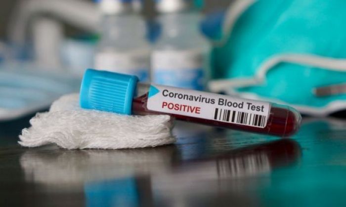 354 случая коронавируса выявлено за сутки в Казахстане 