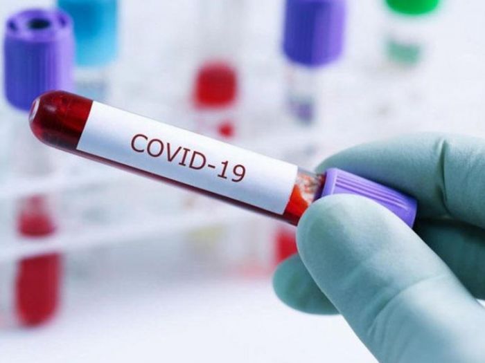 COVID-19 и пневмония в Казахстане: более 15 тысяч случаев за сутки 