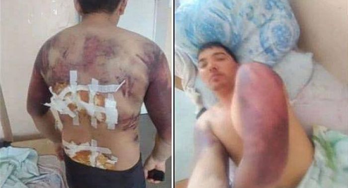 Дело о пытках подозреваемого в сносе памятника Назарбаеву расследуют в Талдыкоргане 