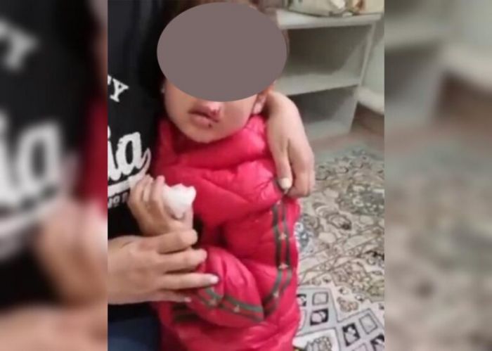 В Атырау бродячая собака укусила 5-летнюю девочку 