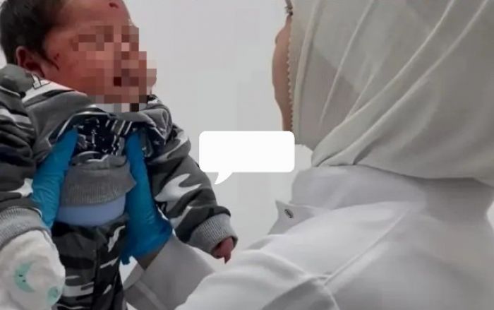 ​Министр здравоохранения прокомментировала видео с кровопусканием младенцу в Атырау