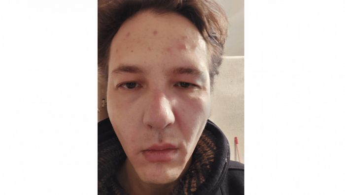 Журналист Данияр Молдабеков сообщил о нападении 