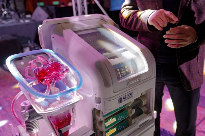 Об изобретении уникального аппарата для хранения донорских органов рассказали в Казахстане