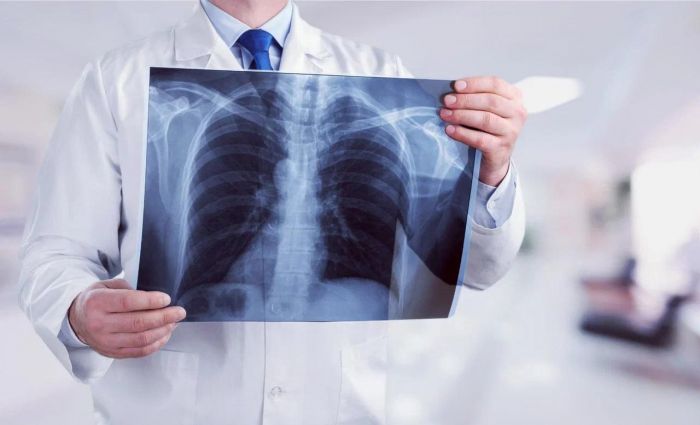 ​Уровень заболеваемости туберкулёзом снизился на 21,1%